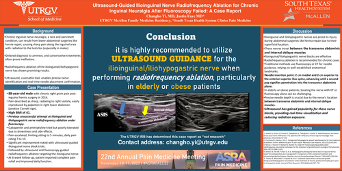 Preview of ULTRASOUND-GUIDED ILIOINGUINAL NERVE RADIOFREQUENCY ABLATION FOR CHRONIC INGUINAL NEURALGIA AFTER FLUOROSCOPY FAILED