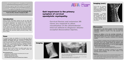 Thumbnail for BALANCING ACT: THE CHALLENGE TO DIAGNOSE NECK INSTABILITY