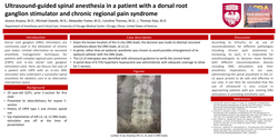 Thumbnail for ULTRASOUND-GUIDED SPINAL ANESTHESIA IN A PATIENT WITH A DORSAL ROOT GANGLION STIMULATOR AND CHRONIC REGIONAL PAIN SYNDROME