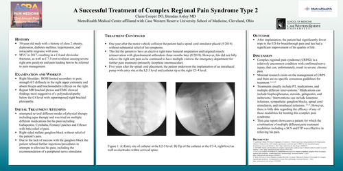 Preview of A SUCCESSFUL TREATMENT OF COMPLEX REGIONAL PAIN SYNDROME TYPE 2