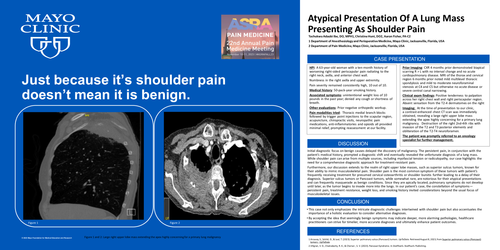 Preview of ATYPICAL PRESENTATION OF A LUNG MASS DISGUISED AS SHOULDER PAIN