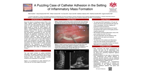 Preview of A PUZZLING CASE OF CATHETER ADHESION IN THE SETTING OF INFLAMMATORY MASS FORMATION