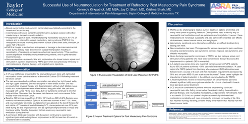 Preview of SUCCESSFUL USE OF SPINAL CORD STIMULATION IN POST MASTECTOMY PAIN SYNDROME