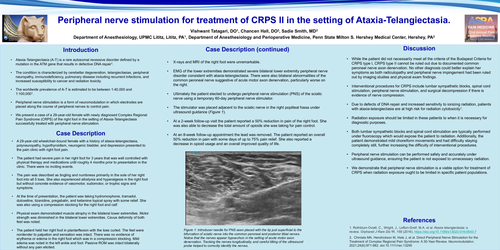 Preview of PERIPHERAL NERVE STIMULATION FOR TREATMENT OF CRPS II IN THE SETTING OF ATAXIA-TELANGIECTASIA.