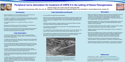 Thumbnail for PERIPHERAL NERVE STIMULATION FOR TREATMENT OF CRPS II IN THE SETTING OF ATAXIA-TELANGIECTASIA.