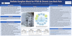 Thumbnail for STELLATE GANGLION BLOCK FOR PTSD & CHRONIC PAIN