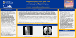 Thumbnail for CASE REPORT ON COMBINED FLUOROSCOPIC AND ULTRASOUND GUIDED ERECTOR SPINAE PLANE BLOCK