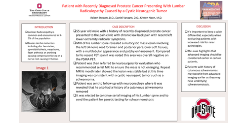 Preview of PATIENT WITH RECENTLY DIAGNOSED PROSTATE CANCER PRESENTING WITH LUMBAR RADICULOPATHY CAUSED BY A CYSTIC NEUROGENIC TUMOR