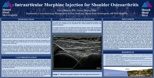 Preview of INTRAARTICULAR MORPHINE INJECTION FOR SHOULDER OSTEOARTHRITIS