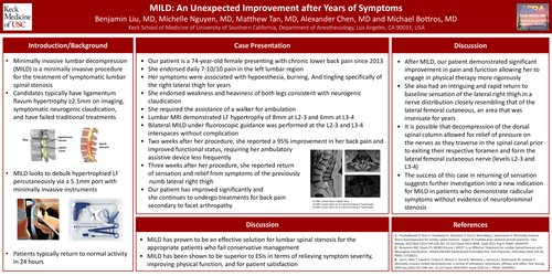 Preview of MILD: AN UNEXPECTED IMPROVEMENT AFTER YEARS OF SYMPTOMS