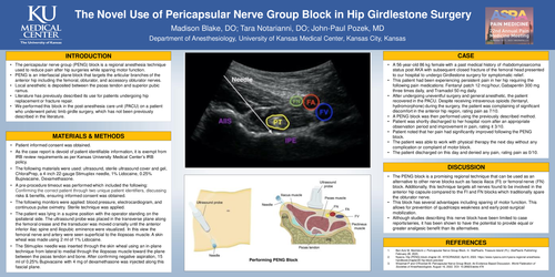 Preview of THE NOVEL USE OF PERICAPSULAR NERVE GROUP BLOCK IN HIP GIRDLESTONE SURGERY