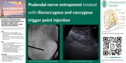 Thumbnail for TREATMENT OF PUDENDAL NERVE ENTRAPMENT BY ILIOCOCCYGEUS TRIGGER POINT INJECTIONS WITH COMBINED X-RAY AND ULTRASOUND GUIDANCE