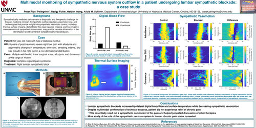 Preview of MULTIMODAL MONITORING OF SYMPATHETIC NERVOUS SYSTEM OUTFLOW IN A PATIENT UNDERGOING LUMBAR SYMPATHETIC BLOCKADE: A CASE STUDY