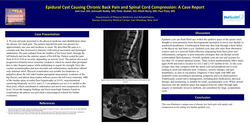 Thumbnail for EPIDURAL CYST CAUSING CHRONIC BACK PAIN AND SPINAL CORD COMPRESSION: A CASE REPORT