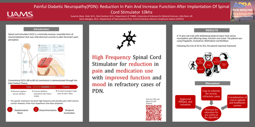 Preview of PAINFUL DIABETIC NEUROPATHY (PDN): REDUCTION IN PAIN AND INCREASE FUNCTION AFTER IMPLANTATION OF SPINAL CORD STIMULATOR 10KHZ