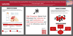 Thumbnail for PAINFUL DIABETIC NEUROPATHY (PDN): REDUCTION IN PAIN AND INCREASE FUNCTION AFTER IMPLANTATION OF SPINAL CORD STIMULATOR 10KHZ