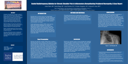 Thumbnail for COOLED RADIOFREQUENCY ABLATION FOR CHRONIC SHOULDER PAIN IN INFLAMMATORY DEMYELINATING PERIPHERAL NEUROPATHY: A CASE REPORT