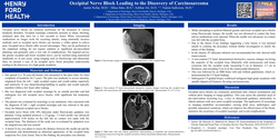 Thumbnail for OCCIPITAL NERVE BLOCK LEADING TO THE DISCOVERY OF CARCINOSARCOMA