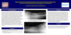 Thumbnail for BILATERAL POSTERIOR SHOULDER DISLOCATION WITH REVERSE HILL-SACHS DEFORMITIES