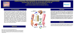 Thumbnail for COMPLEX REGIONAL PAIN SYNDROME S/P CVA IN POLYSUBSTANCE ABUSE PATIENT