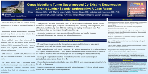 Preview of CONUS MEDULLARIS TUMOR SUPERIMPOSED CO-EXISTING DEGENERATIVE CHRONIC LUMBAR SPONDOARTHERAPY: A CASE REPORT