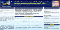 Thumbnail for CONUS MEDULLARIS TUMOR SUPERIMPOSED CO-EXISTING DEGENERATIVE CHRONIC LUMBAR SPONDOARTHERAPY: A CASE REPORT