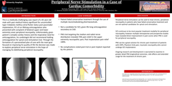Thumbnail for PERIPHERAL NERVE STIMULATION IN A CASE OF CARDIAC COMORBIDITY