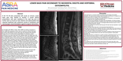 Thumbnail for LOWER BACK PAIN SECONDARY TO INCIDENTAL DISCITIS AND VERTEBRAL OSTEOMYELITIS.
