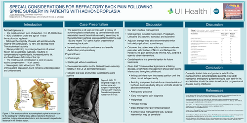 Preview of SPECIAL CONSIDERATIONS FOR REFRACTORY CHRONIC BACK PAIN FOLLOWING SPINE SURGERY IN PATIENTS WITH ACHONDROPLASIA