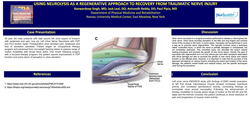 Thumbnail for USING NEUROLYSIS AS A REGENERATIVE APPROACH TO RECOVERY FROM TRAUMATIC NERVE INJURY