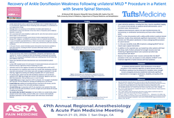 Thumbnail for RECOVERY OF ANKLE DORSIFLEXION STRENGTH FOLLOWING MILD ® PROCEDURE IN A PATIENT WITH SEVERE SPINALSTENOSIS. A CASE REPORT.