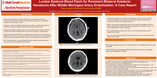 Preview of LUMBAR EPIDURAL BLOOD PATCH FOR PERSISTENT BILATERAL SUBDURAL HEMATOMA AFTER MIDDLE MENINGEAL ARTERY EMBOLIZATION: A CASE REPORT