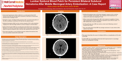 Thumbnail for LUMBAR EPIDURAL BLOOD PATCH FOR PERSISTENT BILATERAL SUBDURAL HEMATOMA AFTER MIDDLE MENINGEAL ARTERY EMBOLIZATION: A CASE REPORT