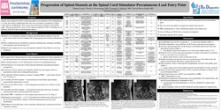 Thumbnail for PROGRESSION OF SPINAL STENOSIS AT THE SPINAL CORD STIMULATOR PERCUTANEOUS LEAD ENTRY POINT