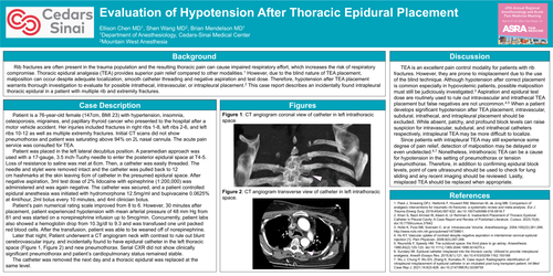 Preview of EVALUATION OF HYPOTENSION AFTER THORACIC EPIDURAL PLACEMENT