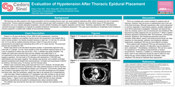 Thumbnail for EVALUATION OF HYPOTENSION AFTER THORACIC EPIDURAL PLACEMENT