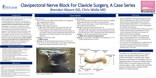 Preview of CLAVIPECTORAL NERVE BLOCK FOR CLAVICLE SURGERY. A CASE SERIES.