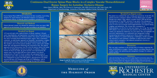 Preview of CONTINUOUS DUAL ERECTOR SPINAE PLANE BLOCKS IN A COMPLEX VASCULAR THORACOBIFEMORAL BYPASS SURGERY FOR AORTOILIAC OCCLUSIVE DISEASE