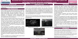 Thumbnail for SUCCESSFUL USE OF REGIONAL ANESTHESIA IN AN ASA 4 PATIENT WITH SEVERE RIGHT VENTRICULAR DYSFUNCTION AND METASTATIC CANCER