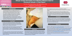 Thumbnail for ALLERGIC CONTACT DERMATITIS FROM MASTISOL ADHESIVE USED FOR PERINEURAL CATHETER: A CASE REPORT