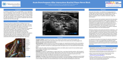 Thumbnail for ACUTE BRONCHOSPASM FOLLOWING INTERSCALENE NERVE BLOCK