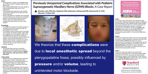 Preview of PREVIOUSLY UNREPORTED COMPLICATIONS ASSOCIATED WITH PEDIATRIC SUPRAZYGOMATIC MAXILLARY NERVE (SZMN) BLOCKS: A CASE REPORT