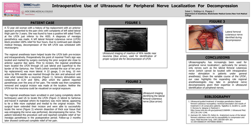 Preview of INTRAOPERATIVE USE OF ULTRASOUND FOR PERIPHERAL NERVE LOCALIZATION FOR DECOMPRESSION