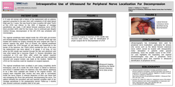 Thumbnail for INTRAOPERATIVE USE OF ULTRASOUND FOR PERIPHERAL NERVE LOCALIZATION FOR DECOMPRESSION