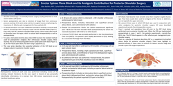 Thumbnail for ERECTOR SPINAE PLANE BLOCK AND ITS ANALGESIC CONTRIBUTION FOR POSTERIOR SHOULDER SURGERY