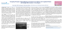 Thumbnail for NAVIGATING THROUGH A CLINICAL DILEMMA IN TREATMENT OF AN ELDERLY ANTI-COAGULATED PATIENT WITH RIB FRACTURES. A CASE REPORT