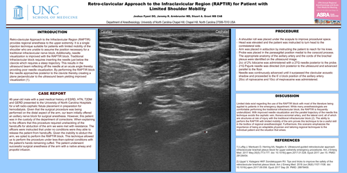 Preview of RETROCLAVICULAR APPROACH TO THE INFRACLAVICULAR REGION (RAPTIR) FOR PATIENT WITH LIMITED SHOULDER MOBILITY