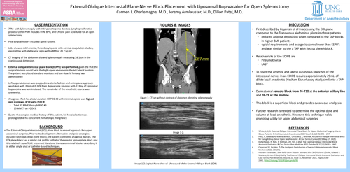 Preview of EXTERNAL OBLIQUE INTERCOSTAL PLANE NERVE BLOCK PLACEMENT WITH LIPOSOMAL BUPIVACAINE FOR OPEN SPLENECTOMY