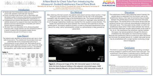 Preview of A NEW BLOCK FOR CHEST TUBE PAIN: INTRODUCING THE ULTRASOUND-GUIDED ENDOTHORACIC FASCIAL PLANE BLOCK