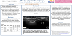 Thumbnail for A NEW BLOCK FOR CHEST TUBE PAIN: INTRODUCING THE ULTRASOUND-GUIDED ENDOTHORACIC FASCIAL PLANE BLOCK